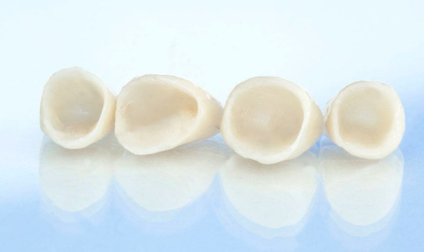 Răng toàn sứ mang lại vẻ đẹp thẩm mỹ cao